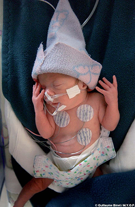 Un bébé avec des électrodes