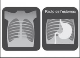 radiographie