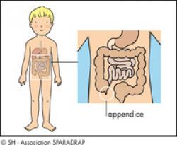 schéma appendice