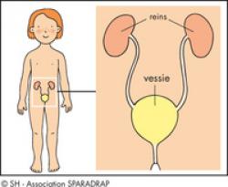 emplacement de la vessie