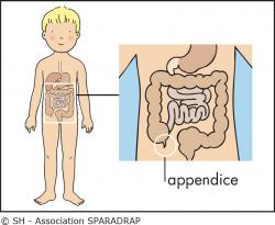 Schéma avec l'intestin et l'appendice